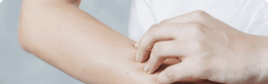 Itching and burning sensation