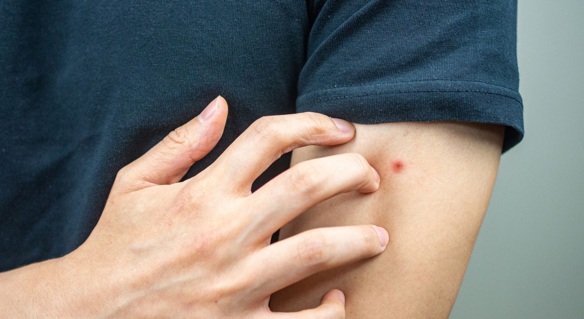 أضرار حشرة البق على الإنسان